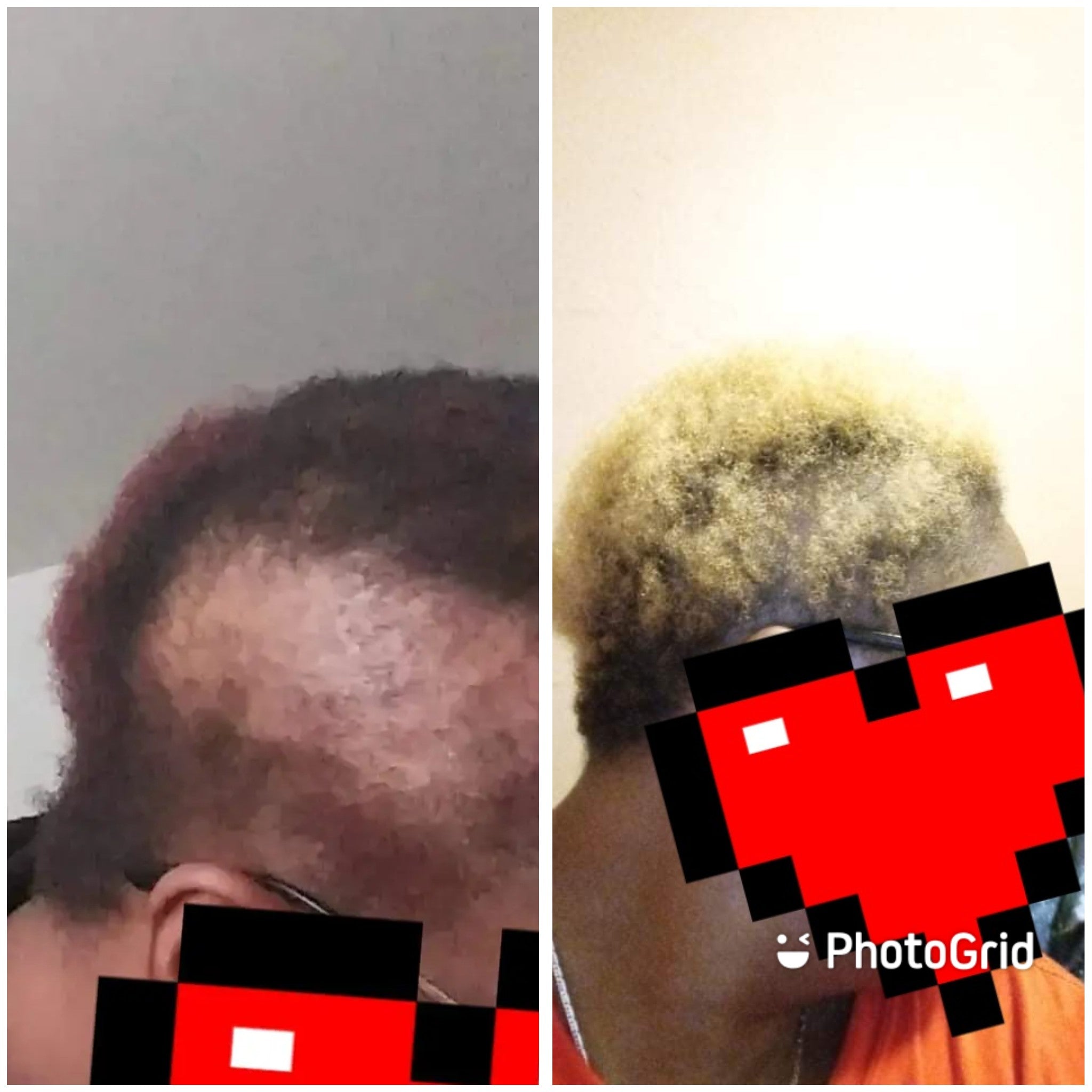Greenhouse herbal hair growth oil before and after results