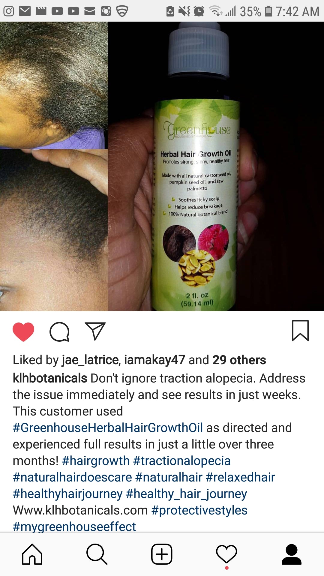 Greenhouse herbal hair growth oil before and after results